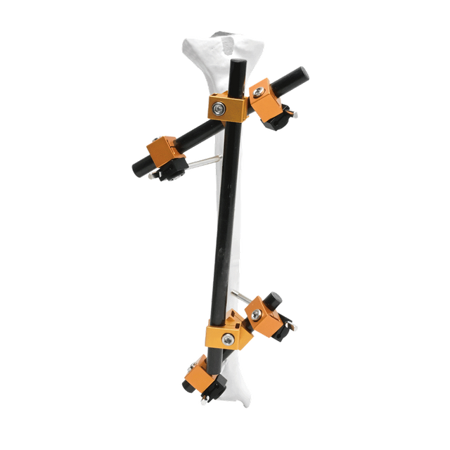 Prefix Proximal External Fixator I