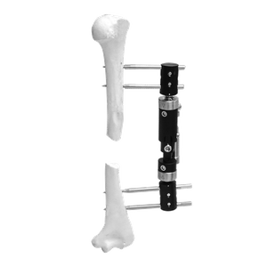 Paediatric Micromotion External Fixator (Straight type)
