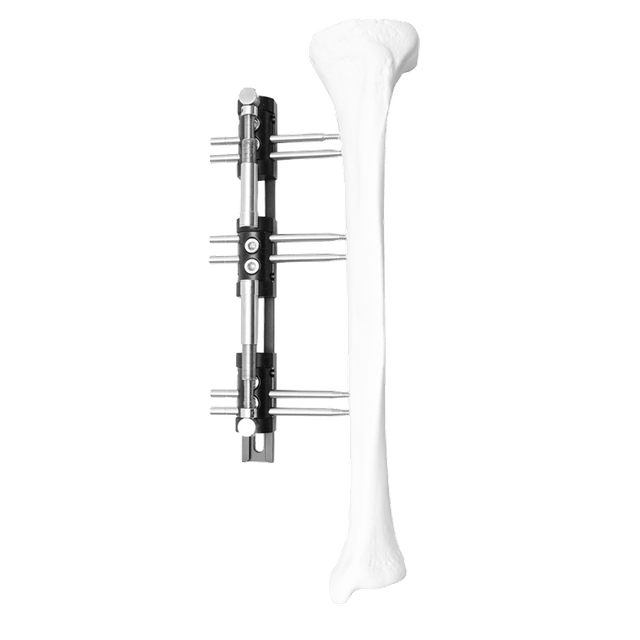 Paediatric Reconstruction External Fixator