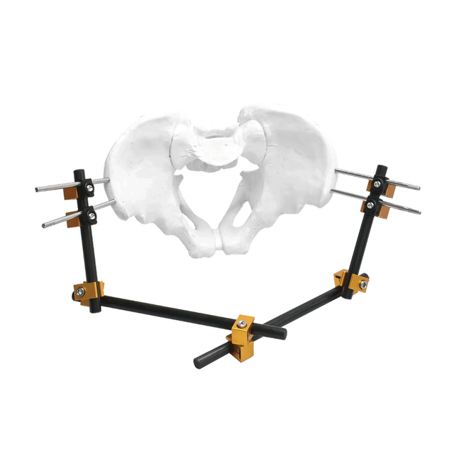 Prefix Pelvic External Fixator