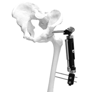 Lower Limb Micromotion External Fixator (Big T-type)