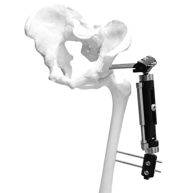 Lower Limb Micromotion External Fixator (Big T-type)