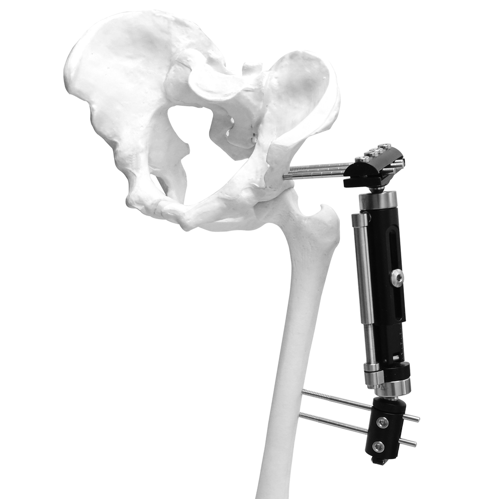 Lower Limb Micromotion External Fixator (Big T-type)