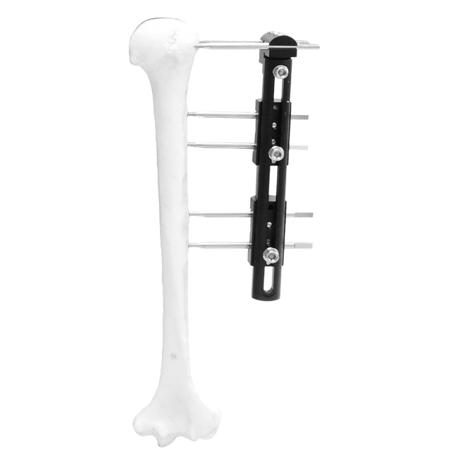 Paediatric Reconstruction External Fixator