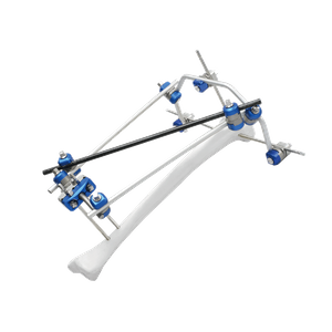 Proximal Tibia External Fixator