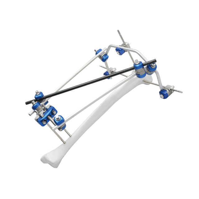 Proximal Tibia External Fixator