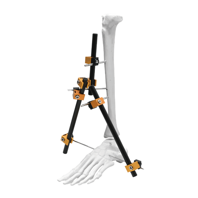 Prefix Proximal External Fixator II