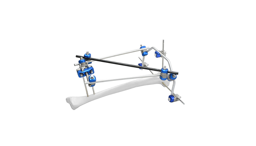 hybrid-external-fixator