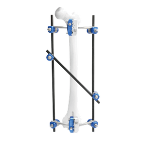 Femoral Shaft External Fixator I
