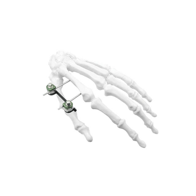 Mini External Fixator I